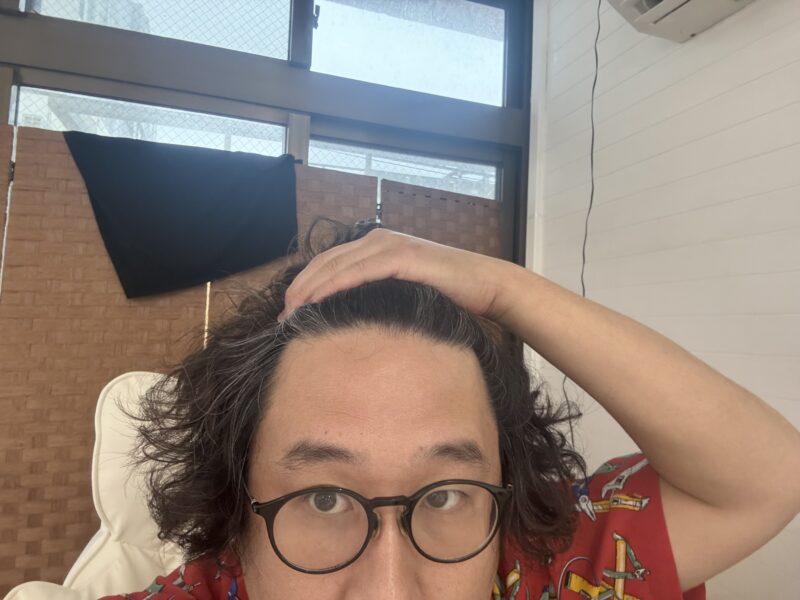 額が広い